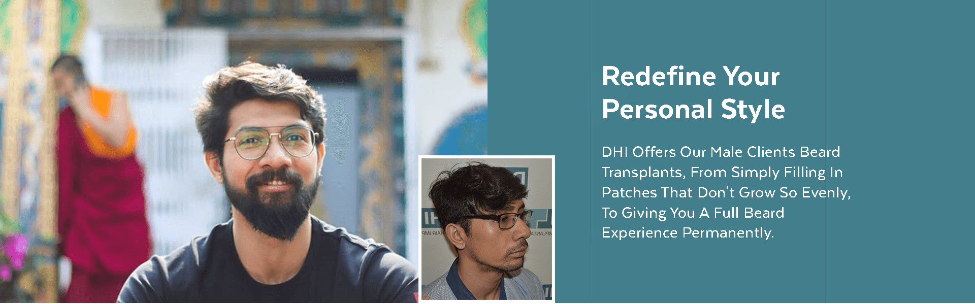 Beard Restoration by DHI
